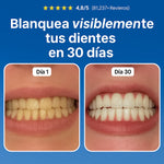 Odontic Reparador de Caries